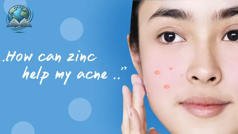 Cách trị mụn tại nhà 2
