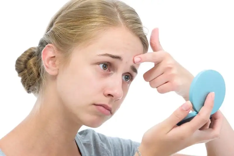 Nguyên nhân gây mụn ở trẻ 10 tuổi