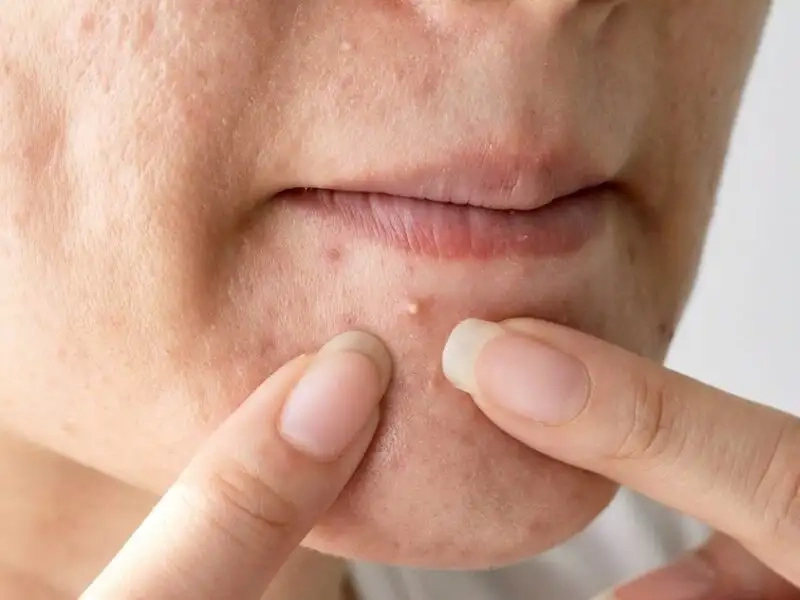 Nguyên liệu thiên nhiên an toàn cho trẻ