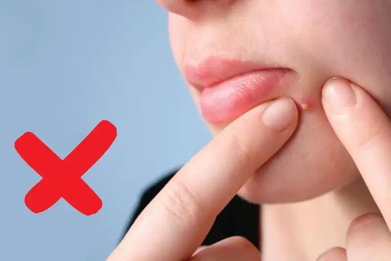 Cách phòng ngừa mụn đinh râu