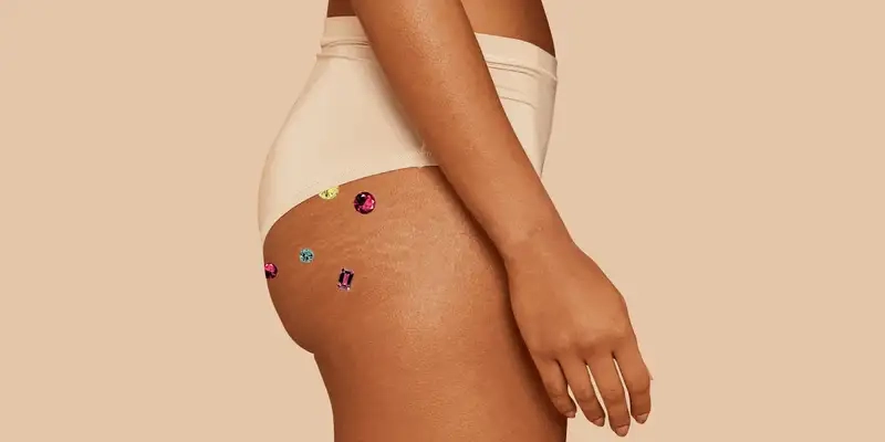 Cách trị mụn ở mông tại nhà nhanh chóng