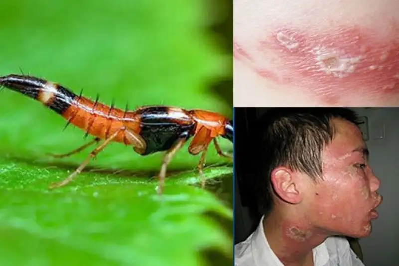 Tác hại của kiến 3 khoang đối với sức khỏe