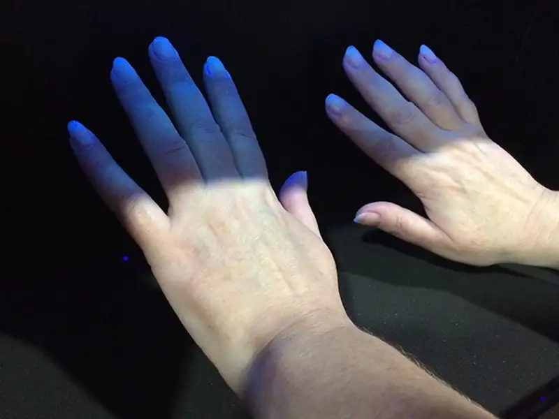 Tác hại đèn UV đối với làn da