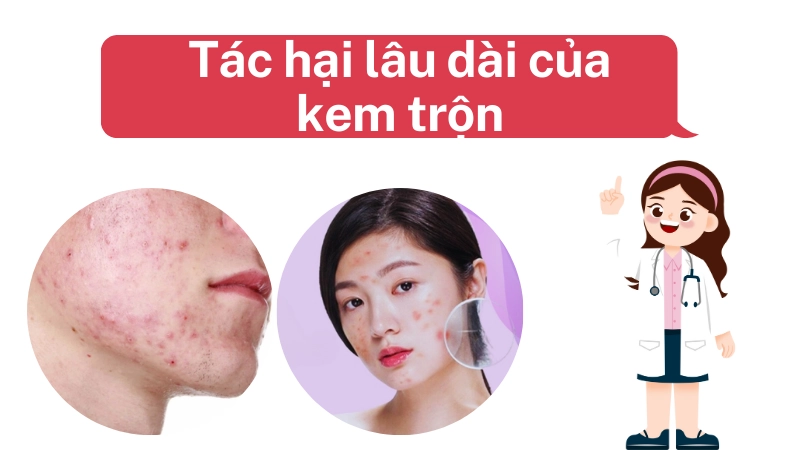 Tác hại lâu dài của kem trộn khiến da xuống cấp nhanh