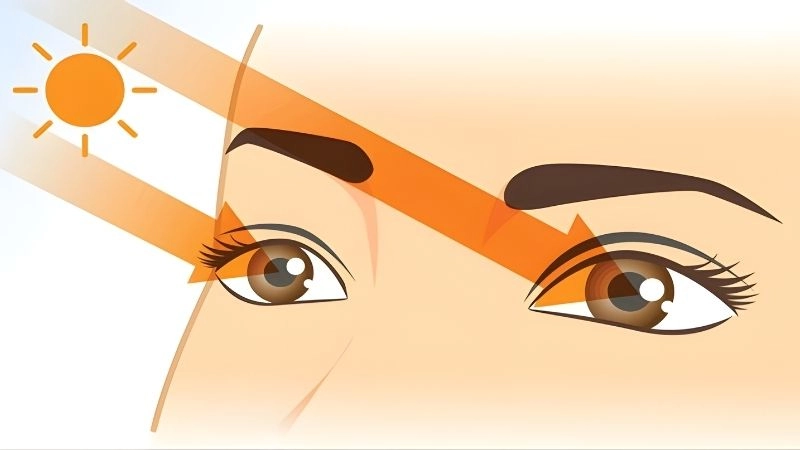 Những tổn thương nghiêm trọng cho đôi mắt