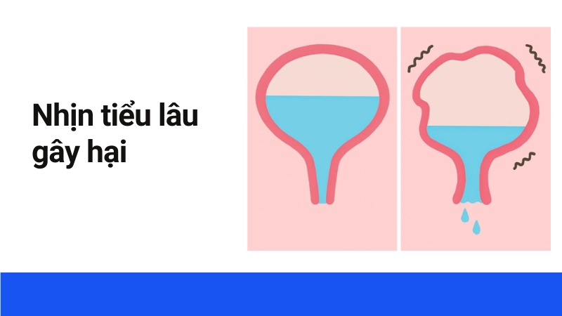 Đừng coi thường tác hại của việc nhịn tiểu kéo dài